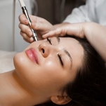 Microdermabrasion