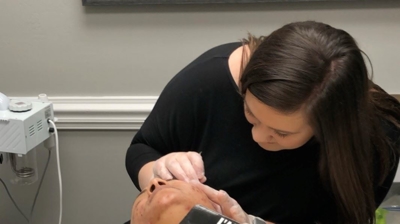 Derma Peel Photo