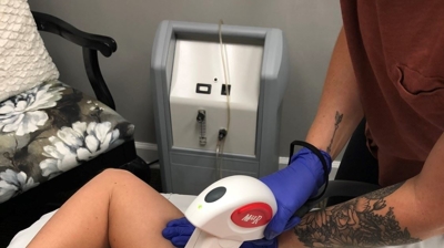 Laser Hair Removal Photo