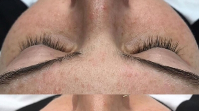 Before and After volume set Photo