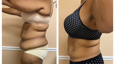 NuBody Contour Photo