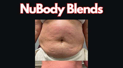 NuLipo Ex Advanced Photo