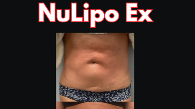 NuLipo Ex Advanced Photo