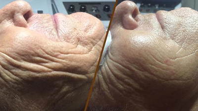 Rezenerate Facials Photo