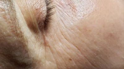 Rezenerate Facials Photo