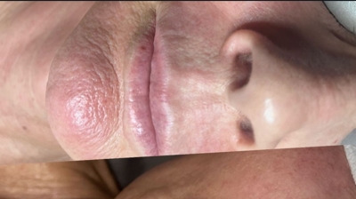 Rezenerate Facials Photo