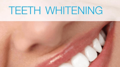 Teeth Whitening Photo