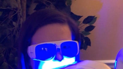 Teeth Whitening Photo