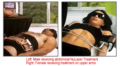 Nu Lazer Treatments